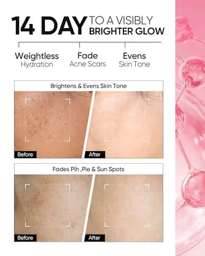 SKINTIFIC Niacinamide Brightening Moisturizer 2.82oz | Hydrates & Supports Radiance thumbnail 3