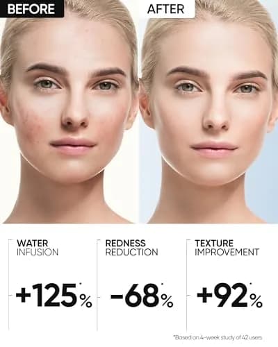 Skintific Truffle Biome Skin Cream Gel Moisturizer 30g | Calms Sensitive Skin & Reduces Redness thumbnail 5