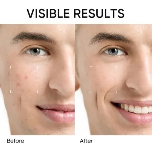 SKINTIFIC Mugwort Clay Stick Face Mask with Centella & Salicylic Acid | Calms Redness & Pores, 40g (1.41 Oz) thumbnail 5