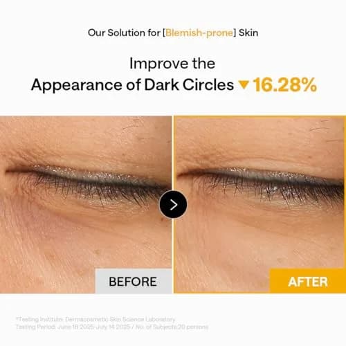 MEDIHEAL Vitamin C Collagen Capsule Eye Patches 60 Count | Brightening & Firming Hydrogel Pads for Dark Circles & Fine Lines thumbnail 6