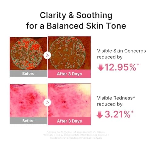 medicube PDRN Pink Peptide Serum with Salmon DNA 30ml (1.01 fl. Oz) | Hydrating & Glow-Enhancing thumbnail 4