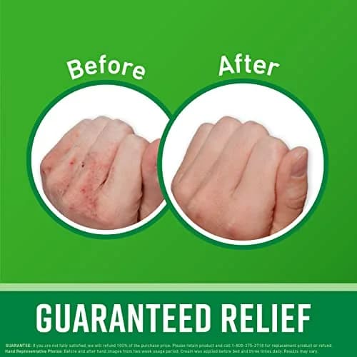 O'Keeffe's Hand & Foot Cream Pack (6.6 oz) | Repairing Skincare for Dry, Cracked Skin thumbnail 2