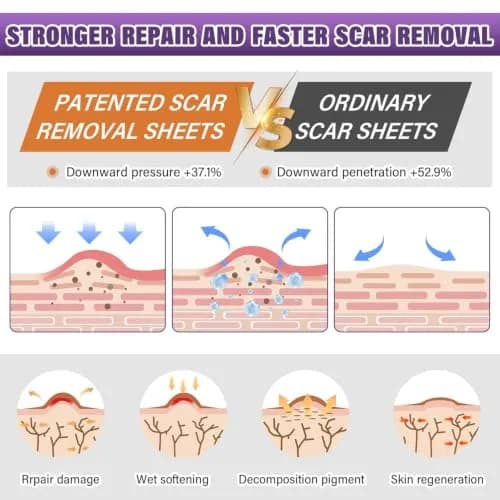 PSECICI Silicone Scar Sheets Medical Grade Tape for Old & New Scars 3M (1.6" x 120") | Advanced Scar Treatment thumbnail 3