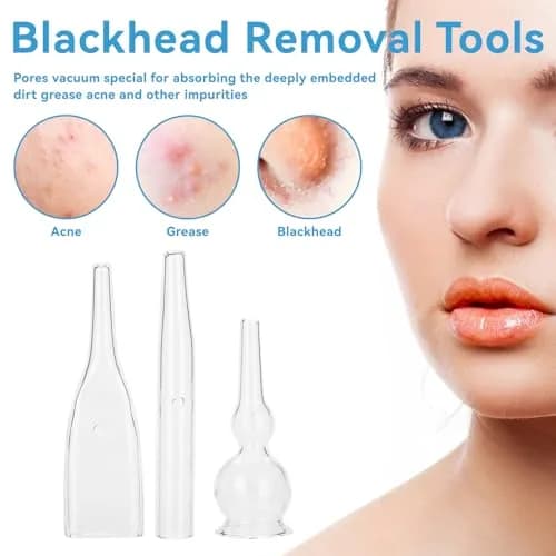 Agatige Blackhead Removal Glass Tube Kit (Pack of 3) | Vacuum Suction Pore Cleaner Accessories thumbnail 2